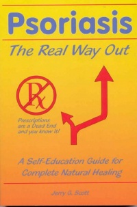 Psoriasis: The Real Way Out: A Self-Education Guide to Complete Natural Healing Psoriasis: The Real Way Out: A Self-Education Guide to Complete Natural Healing