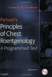 Felson's Principles of Chest Roentgenology Text with CD-ROM, 3e (Goodman, Felson's Principles of Chest Roentgenology) Felson's Principles of Chest Roentgenology Text with CD-ROM, 3e (Goodman, Felson's Principles of Chest Roentgenology)