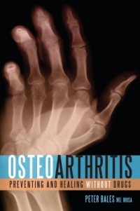 Osteoarthritis: Preventing and Healing Without Drugs Osteoarthritis: Preventing and Healing Without Drugs